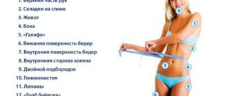Основные зоны на теле, которые подлежат коррекциии Аквалисом